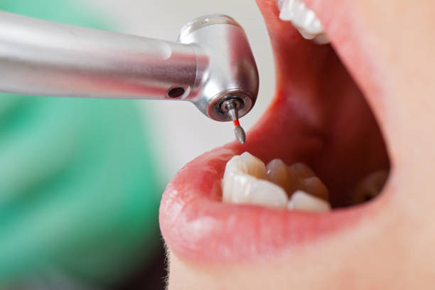 Best Emergency Treatment for Toothache in Grand Island, NE